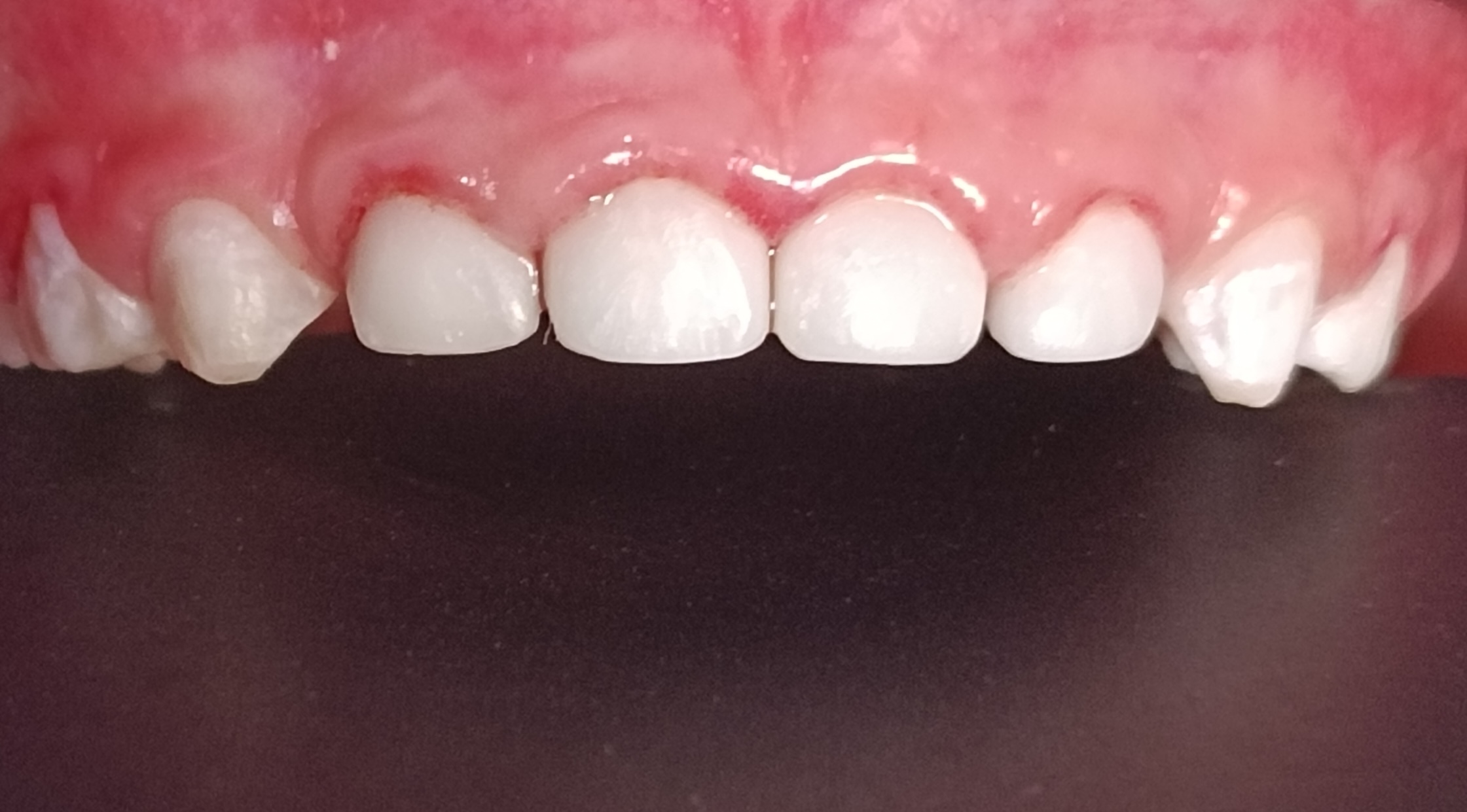 After