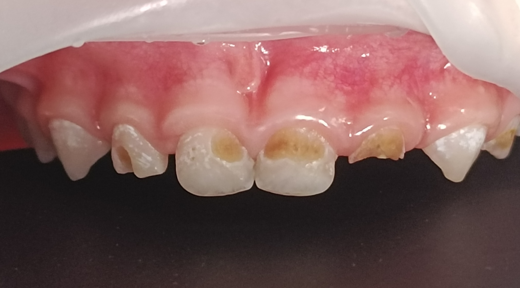 Before